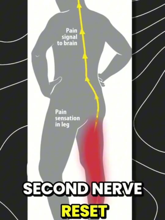 A nerve diagram from the video on the nerve reset